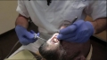 Cliniche dentali low-cost